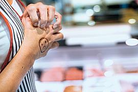 Fleischereifachverkäuferin kratzt sich an der Hand wegen einer Hauterkrankung